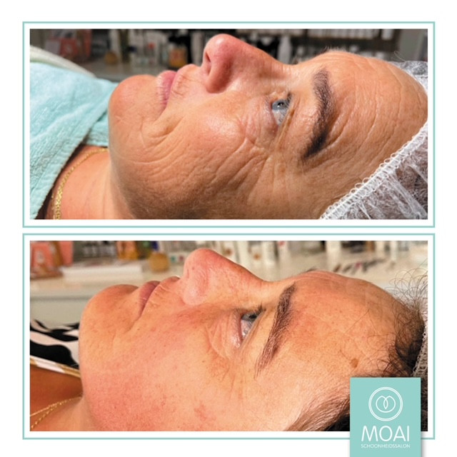 photo - Schoonheidssalon MOAI