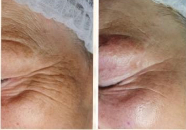 photo - Schoonheidssalon MOAI